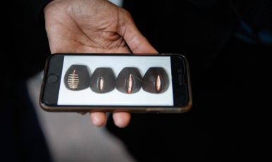 En bild visas på en iPhone på modeller av de fyra olika typerna av kvinnlig könsstympning.